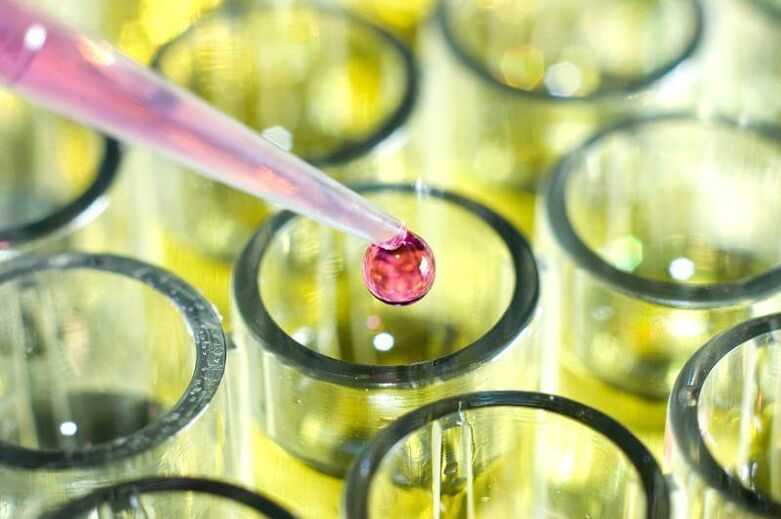 So machen Sie Tests für Parasiten