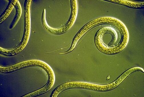 Parasitäre Fadenwürmer, die im menschlichen Dünndarm leben