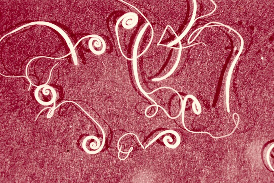menschliche Trichinella-Würmer