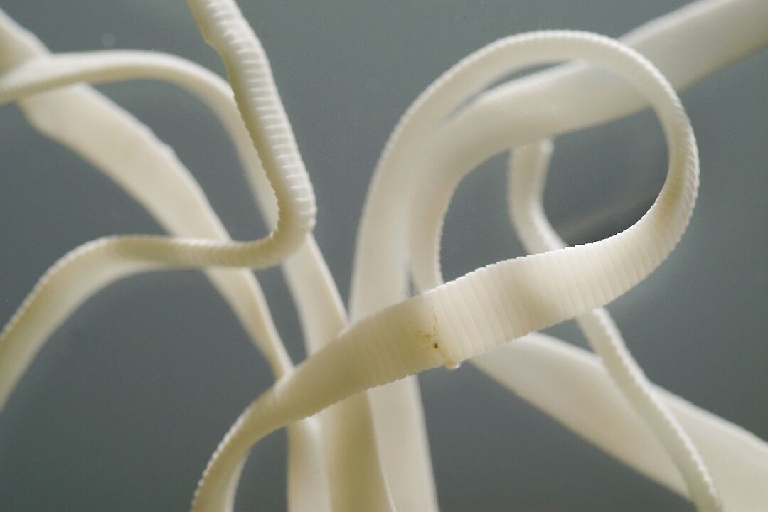 menschlicher Spulwurm