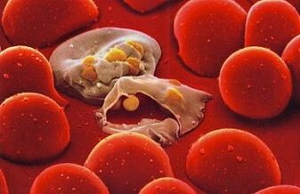 Malaria-Plasmodium im menschlichen Körper