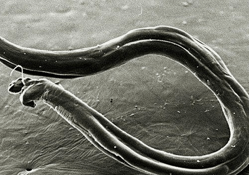 Wie Hakenwürmer im menschlichen Körper aussehen