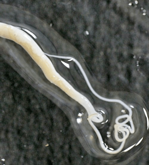 Wie Peitschenwürmer im menschlichen Körper aussehen