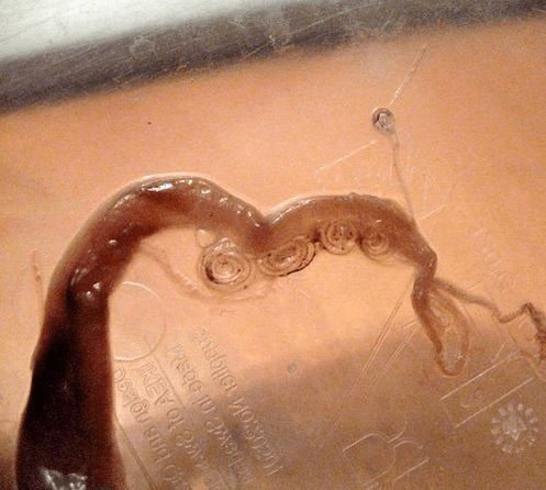 Wie sieht ein Zwergbandwurm im menschlichen Körper aus 