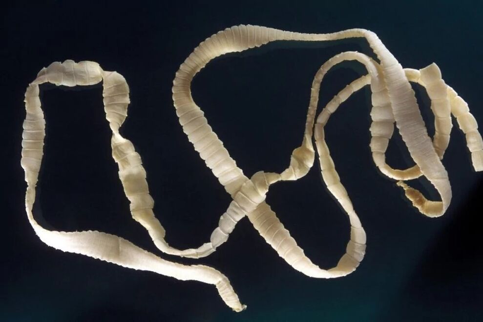 Bandwurm, ein Parasit des menschlichen Körpers
